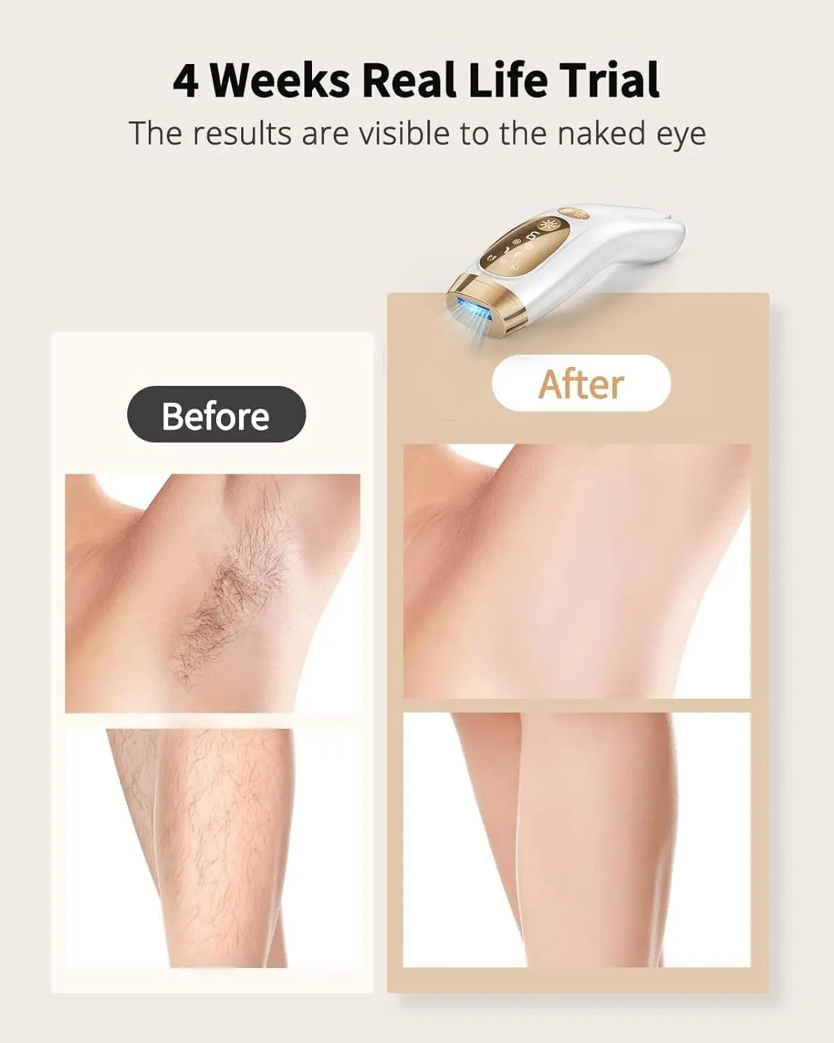 IPL Laser-Haarentferner – 9 Stufen, Ice-Cooling, Unbegrenzte Blitze für Ganzkörper